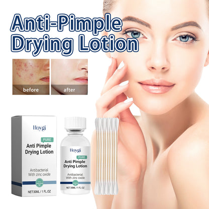 Fade Acne Cream Facial Cleaning And Repair Smallpox Diluting